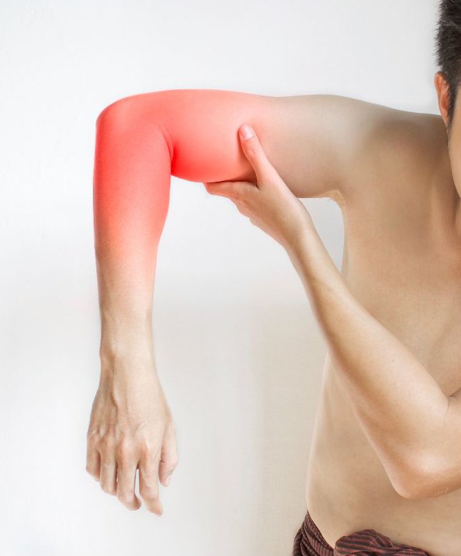 Tennis Elbow (Lateral Epicondylitis)