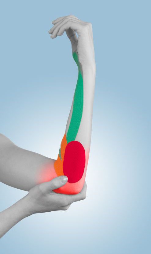 How Physiotherapy Helps Tennis Elbow