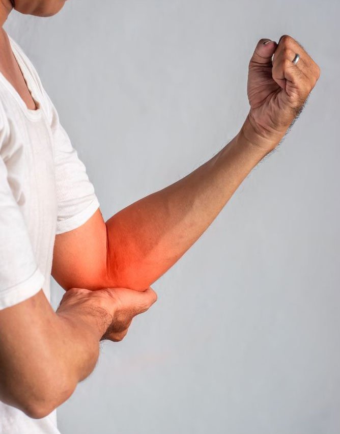 Physiotherapy for Tennis Elbow: